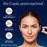 BioRewind infographic with a woman holding two supplement capsules and text that reads 'After 12 weeks, patients experienced*:' followed by three circular callouts: '30% reduction in rough skin texture,' '20% reduction in skin dullness,